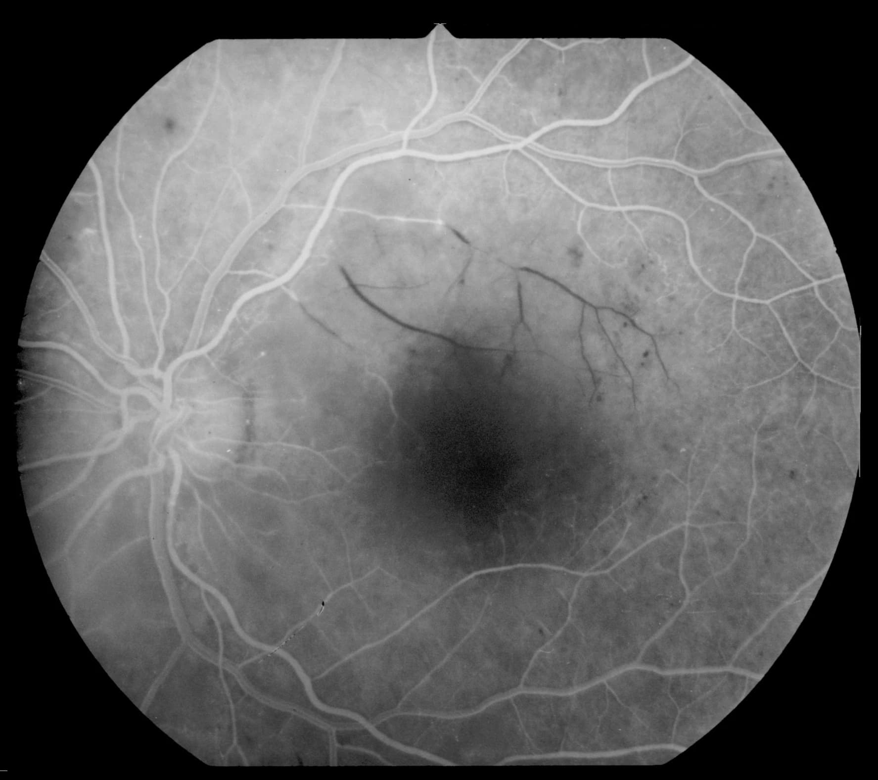 Retinal angiography showing vascular network and blood flow patterns